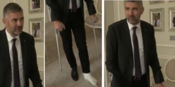 Dubrovački gradonačelnik došao s gipsom na posao. “Boli ko vrag, ali jednako boli i nepravedan porez na apartmane”